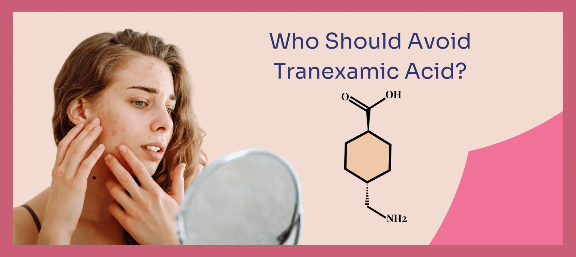 網(wǎng)紅“氨甲環(huán)酸”被批準(zhǔn)用于色斑治療了嗎？